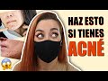 ✅ 8 TIPS para ELIMINAR ACNÉ por MASCARILLA ➡️[FUNCIONA!]