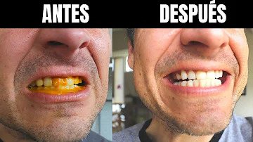 ¿Cómo se aplica la cúrcuma en los dientes?