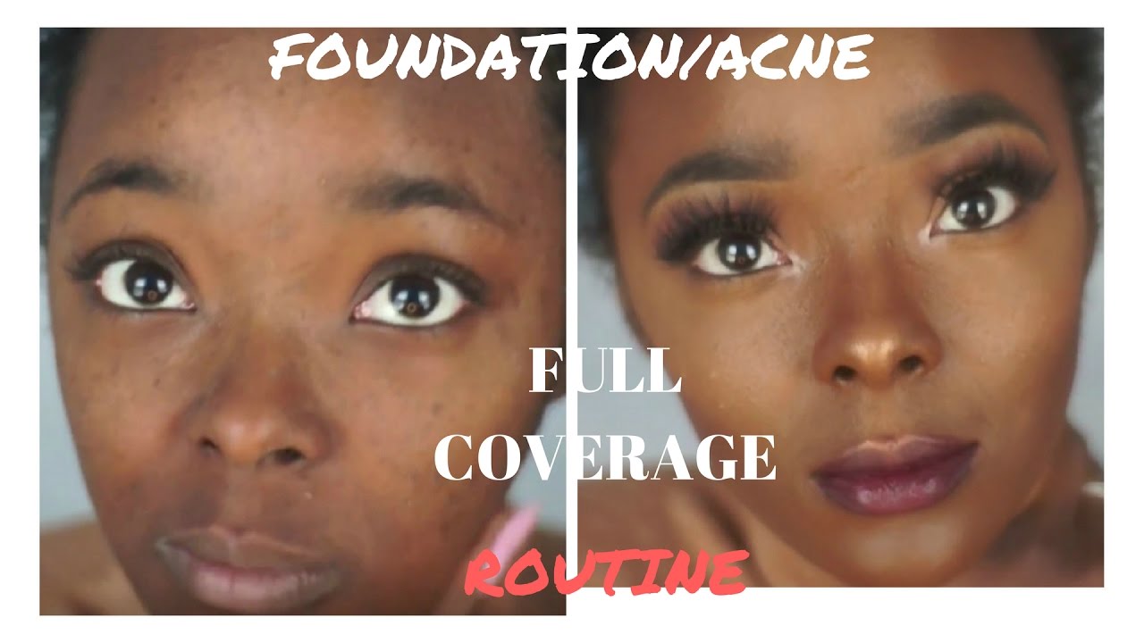 Flawless  Full Coverage Foundation Routine for Oily Skin l Acne Scar Coverage