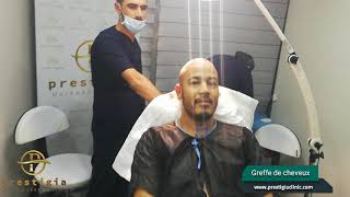 hair transplant / greffe cheveux /زراعة الشعر في تركيا