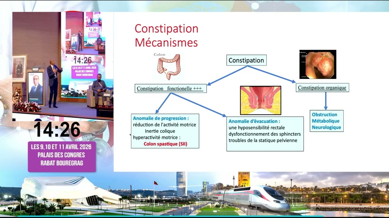 Actualités de la prise en charge du syndrome de l'intestin irritable avec constipation.