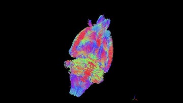 Rat brain tractography with 9.4T preclinical MRI scanner