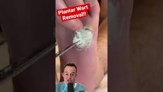 DOCTOR REACTS: SATISFYING WART REMOVAL!😱 #shorts screenshot 4