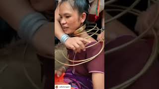 Oha Kafası Sıkışmış