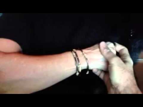1 Reducing Nursemaid's Elbow