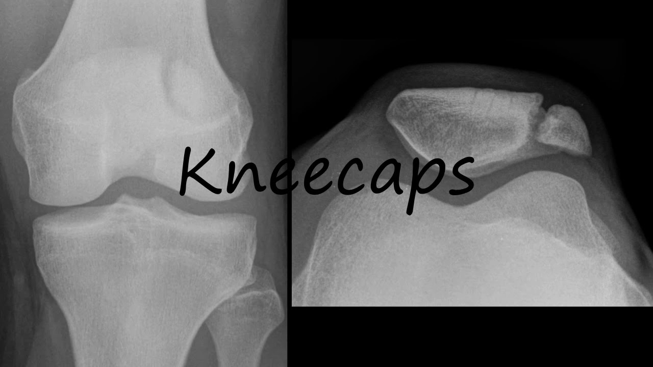 How to Pronounce Kneecaps? - YouTube