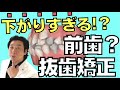 抜歯矯正したら口元が下りすぎないか心配！？