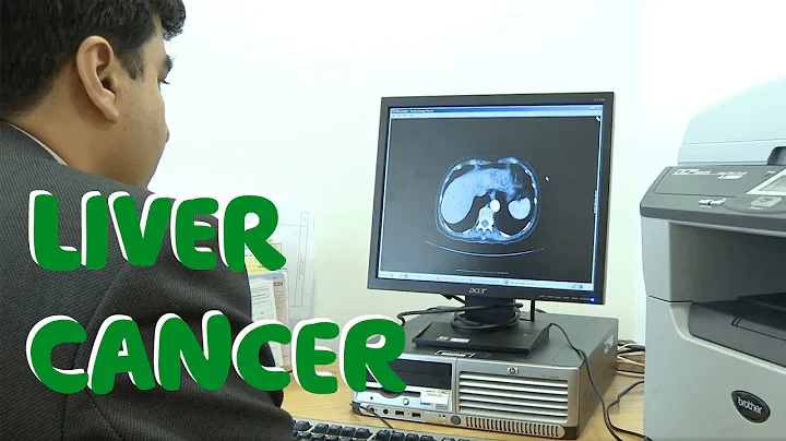 What Is Liver Cancer? (Symptoms, Causes & Treatments)  - Macmillan Cancer Support - DayDayNews