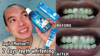 WHITER TEETH IN JUST 7DAYS + WHITENING ROUTINE WITH PERFECT SMILE + MGA DAPAT IWASANG PAGKAIN