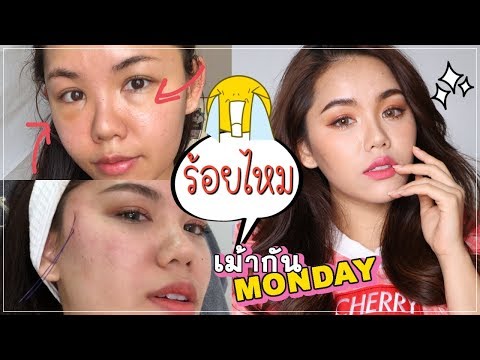 สวยขึ้น ร้อยไหมครั้งแรก กลัวฉี่จะราด | เม้ากันMonday EP7 Wonderpeach