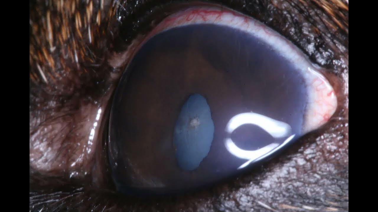 Fara biopsie iris bombé suspicion tumeur uvéale OG 221220 YouTube