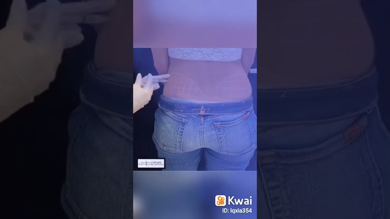 #Lipostabil