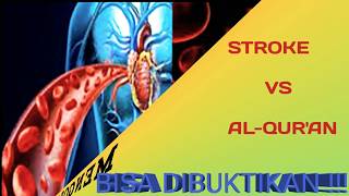 Cara Therapy Titik Syaraf Stroke Cara Therapy Titik Syaraf Stroke