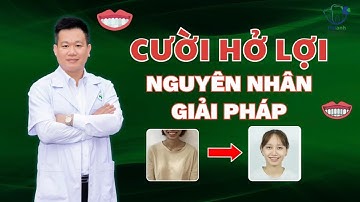 CƯỜI HỞ LỢI , NGUYÊN NHÂN VÀ GIẢI PHÁP