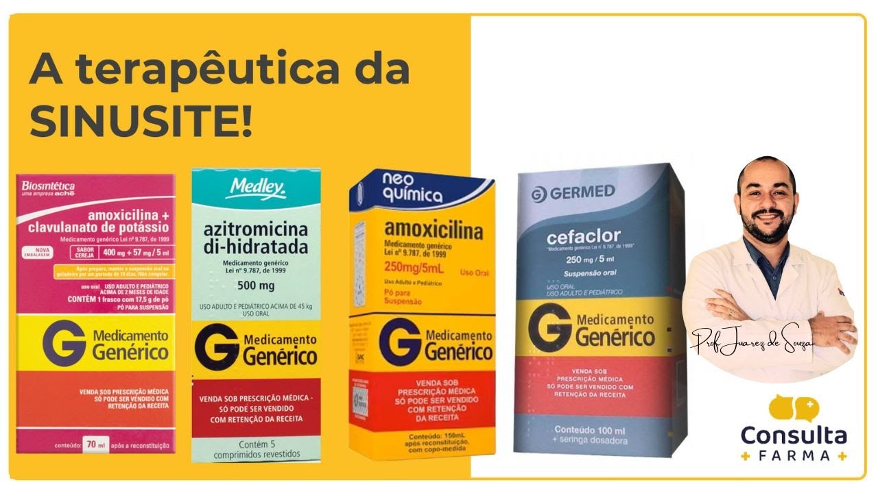 Qual o tratamento para SINUSITE? - YouTube