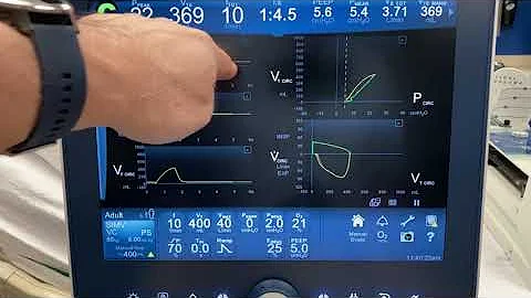 Ventilator Waveforms