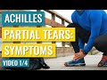 Partial Achilles Tear/Rupture Symptoms Video 1/4