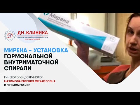 МИРЕНА - УСТАНОВКА внутриматочной гормональной спирали