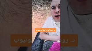 حبوب فروه الرأس@د روماني وهبه