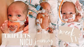 27 weeker *MICRO PREEMIE TRIPLETS* NICU JOURNEY: week 11