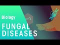 Fungal Diseases | Health | Biology | FuseSchool