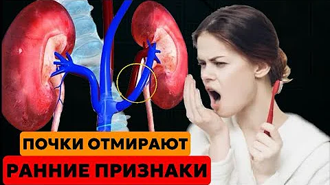 10 ранних Признаков того,что ваши почки ОТМИРАЮТ! 90% людей не знают об этих ПРИЗНАКАХ! #здоровье