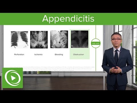 Video: Appendisitis: waar om te wees en hoe seer dit is