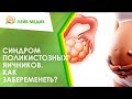 👩‍🦰 Как забеременеть с синдромом поликистозных яичников?