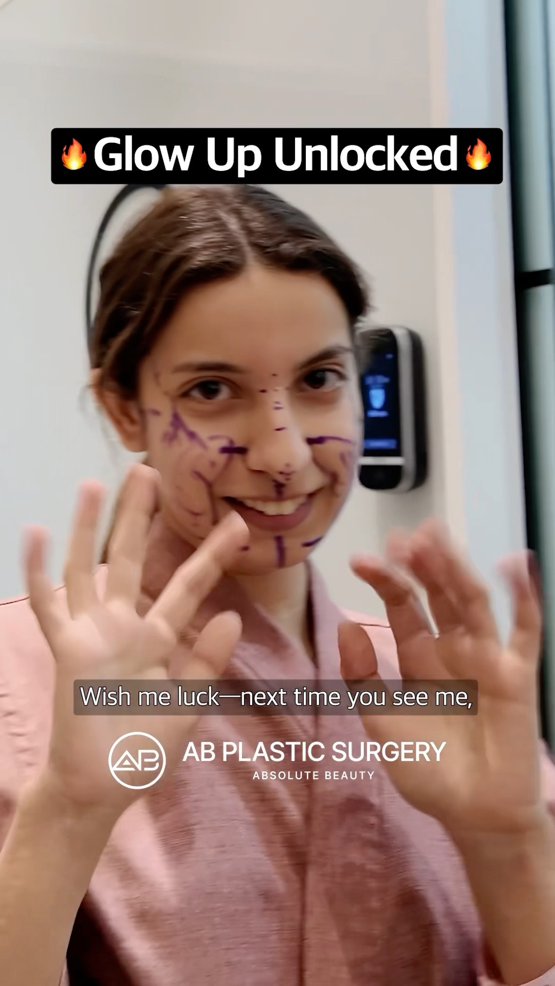 Korean Plastic Surgery, Month 4 Reveal #shorts