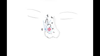How to draw a Bilobe Flap
