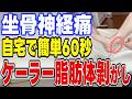 知らないとヤバい!?坐骨神経痛を治す「ケーラー脂肪体剥がし」