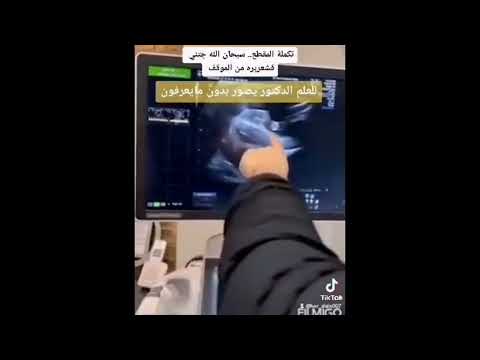 دكتور يفاجئ مريضه انها حامل في 5 بعد غياب 10 سنوات صدقني هتكبي علي فرحتها