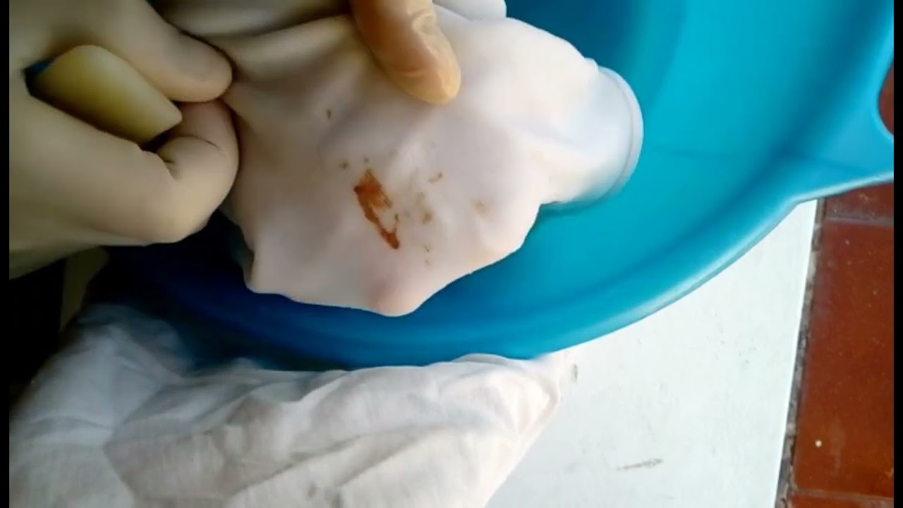 Come togliere macchie di sangue dai tessuti - YouTube