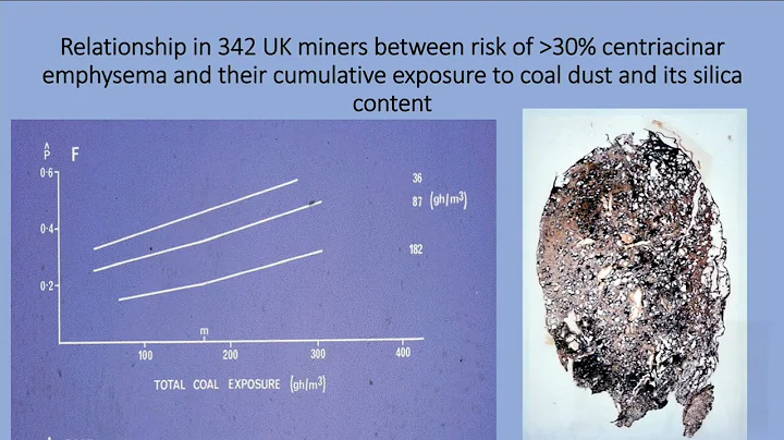 Inhaled Particles 2022: Speaker 2 - Anthony Seaton