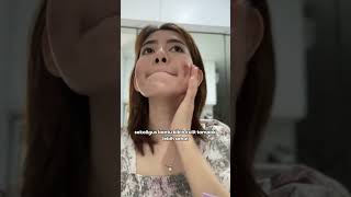 jangan takut buat treatment dermapen ya!🤩💜✨ #fyp #solcare #viral