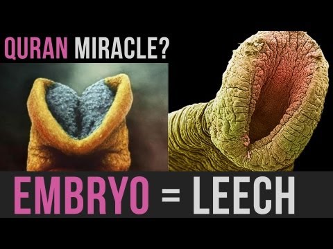 EMBRYO = LEECH | AMAZING QURAN MIRACLE | #MINDBLOW