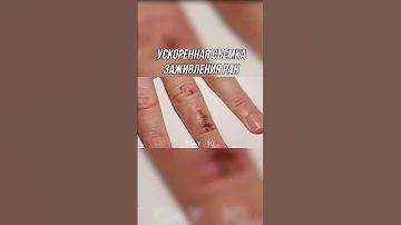 Ускоренная съемка заживления ран 😲 #Shorts
