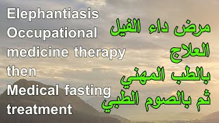 مرض داء الفيل والعلاج بالصوم الطبي Elephantiasis and treatment with medical fasting