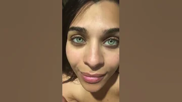 Jade Green Permanent Eye Color Change 2018 Brightocular