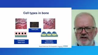 Brittle Bone Conference 2021 Clinical Trials Update - Prof Richard Keen