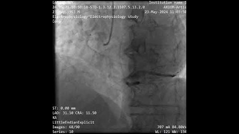 mov allPatients 23-05-2024