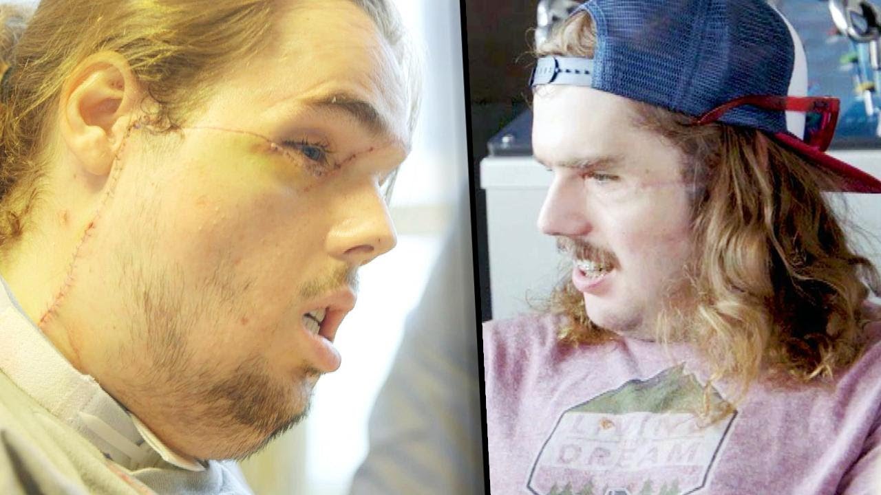 California Man Gets Most Advanced Transplant Ever California Man Gets Most Advanced Transplant Ever