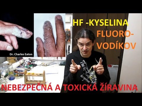 Video: Jaká kyselina se používá při leptání skla?