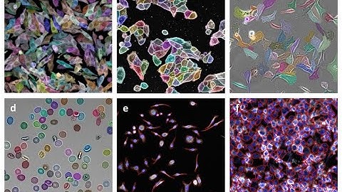 Single Molecule & Spatial Sequencing: Introduction to Spatial Omics