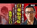 香田晋が白血病で変わり果てた姿...緊急逮捕された理由に言葉を失う...『手酌酒』で有名な演歌歌手の芸能界から干された原因...現在の職業に驚きを隠せない...