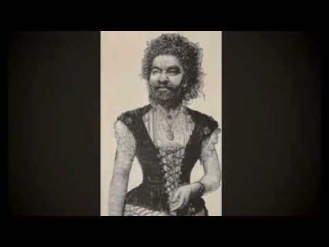 Julia Pastrana The Ugliest Woman" জুলিয়া পাস্ত্রানা "পৃথিবীর কুৎসিততম নারী