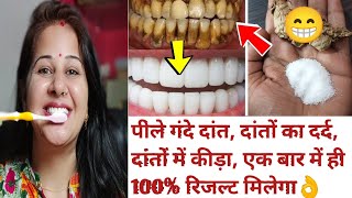 Teeth whitening at home in 2 minutes /how to Naturally whiten your yellow teeth कीड़ा,दर्द खत्म