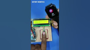 smart watch project #smartwatch #project