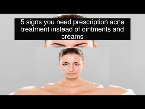 5 signs you need prescription acne treatment instead of ointments and creams