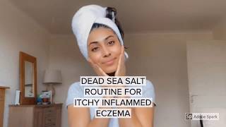 How I Soothe Itchy Eczema with Dead Sea Salt